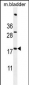 ACN9 Antibody  (N-term)